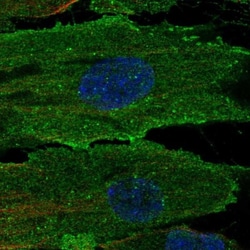 Endosialin/CD248/TEM1 Antibody, Novus Biologicals:Antibodies:Primary Antibodies
